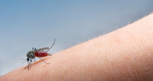 Natural Mosquito Bite Cures