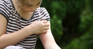 4 Natural Mosquito Repellents to Rival DEET