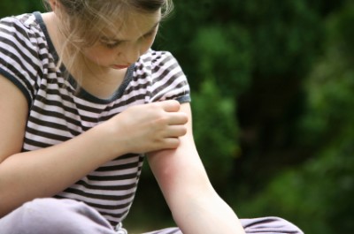 girl with mosquito bite, scratching hand has motion blur