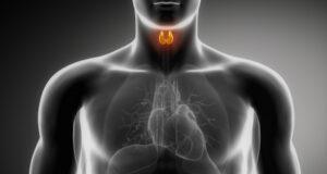 An All-Natural Approach To Thyroid Disease