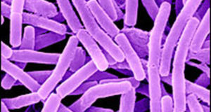 The Pentagon Just Accidentally Shipped LIVE Anthrax To 9 States
