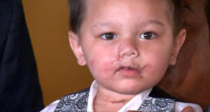 The SWAT Raid That Nearly Killed This Toddler Never Should Have Happened, And You Won’t Believe Why