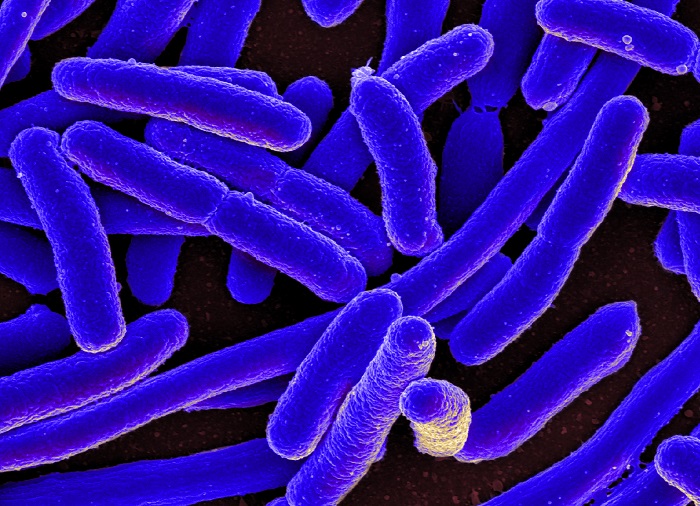 The Dreaded Antibiotic-Resistant Superbug We Long Feared Has Arrived