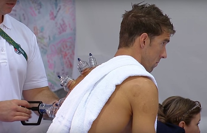 Cupping: The Ancient Off-Grid Therapy Used By Michael Phelps