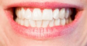 4 Simple, All-Natural Steps To Rebuilding Your Gums (That Don’t Involve The Dentist)