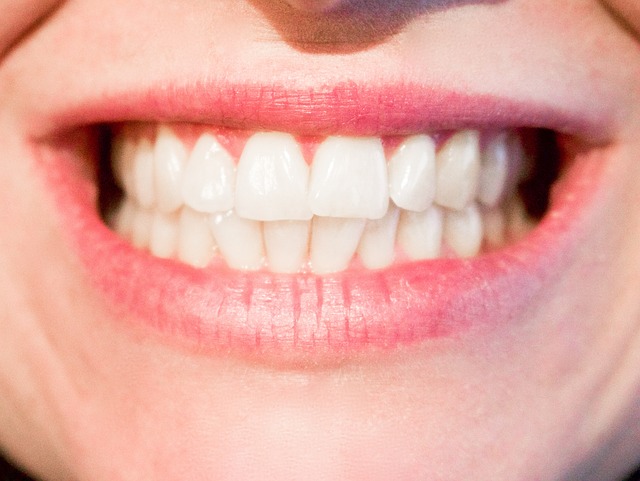4 All-Natural Steps To Rebuilding Your Gums (That Don't Involve The Dentist)